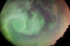 aur26juil044re copy.jpg (31160 bytes)